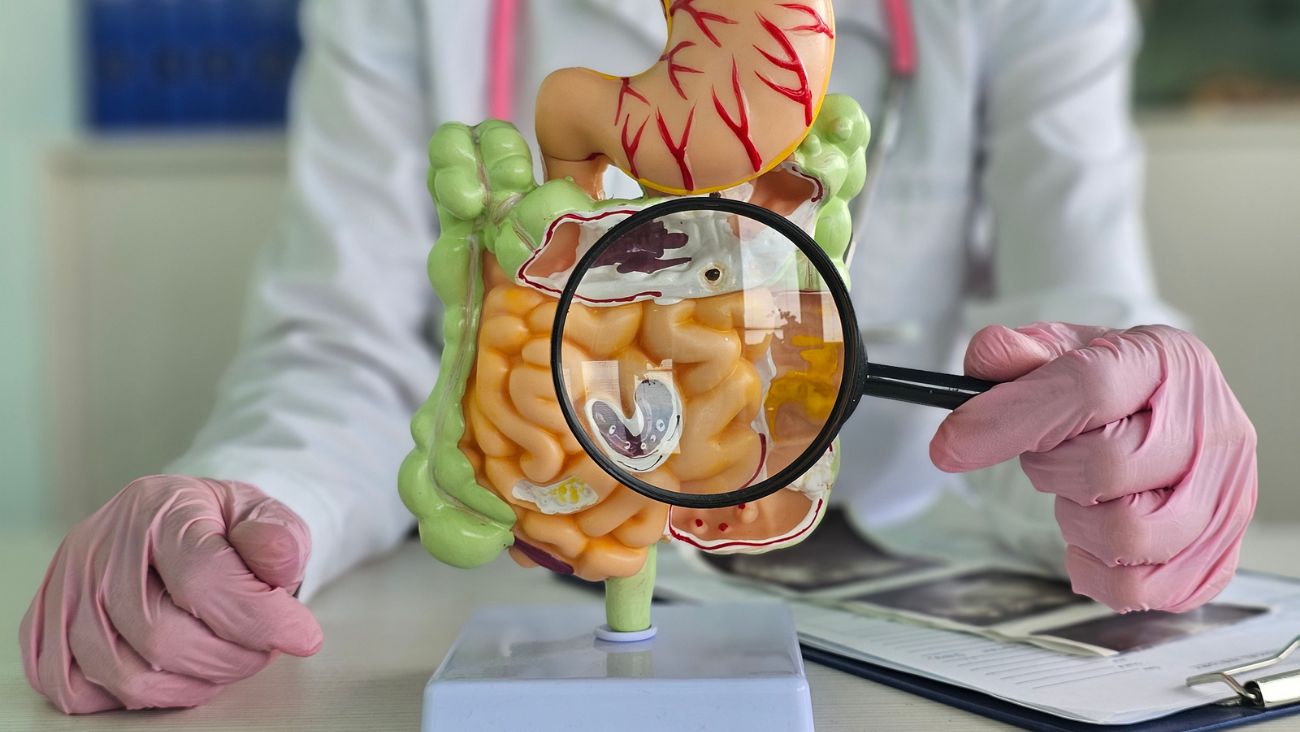 Ese alimento que ignoras podría salvarte la vida; ayuda a prevenir un cáncer agresivo