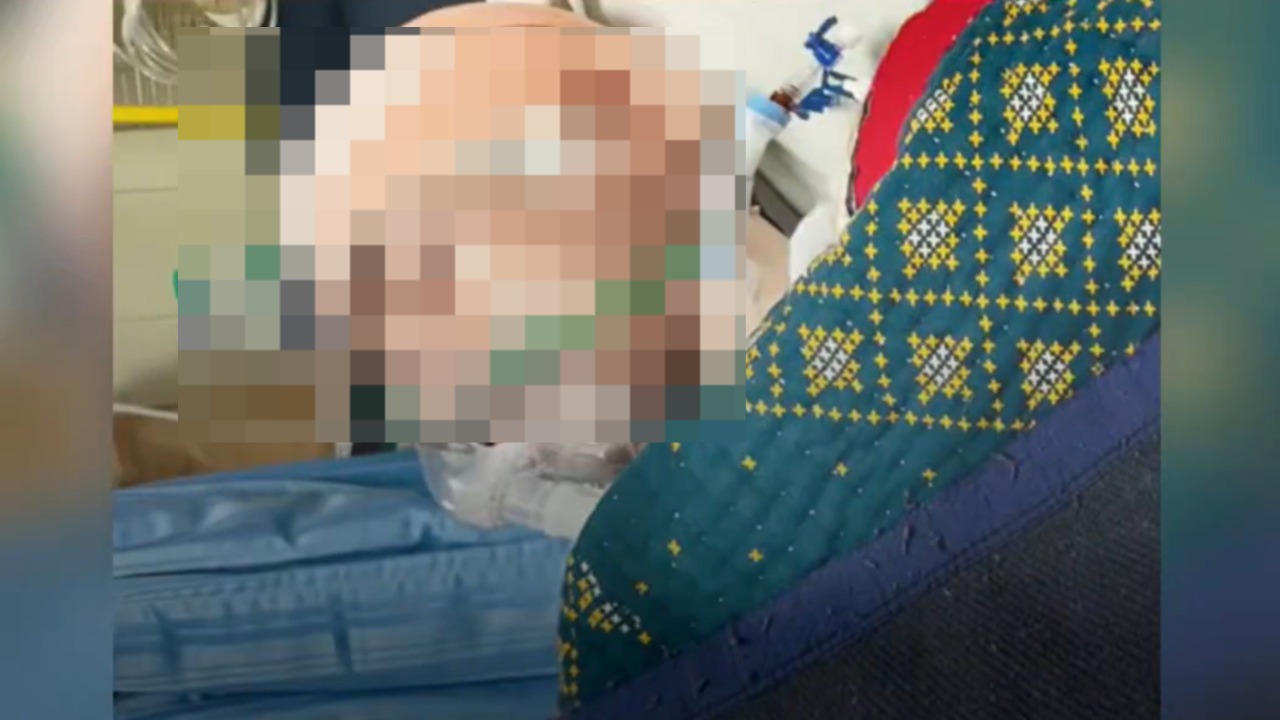 VIDEO: Hombre llega caminando al hospital con una hoja de metal en la cabeza y hasta usa su celular: ¿Cómo terminó así?