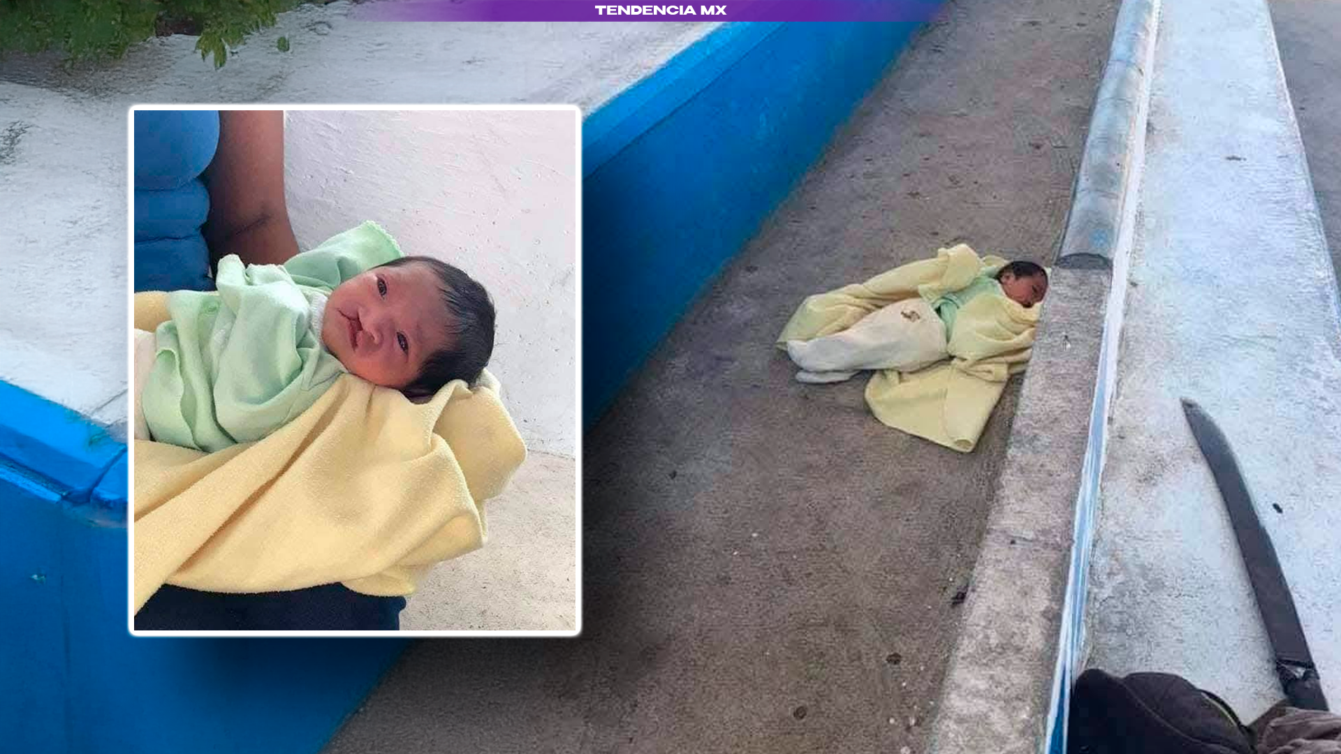 Bebé con labio leporino abandonado en Nacajuca, Tabasco, en 2018